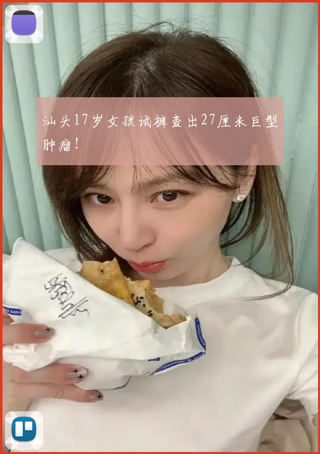 汕头17岁女孩试裤查出27厘米巨型肿瘤!